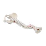 Spine model with prolapse and pelvis