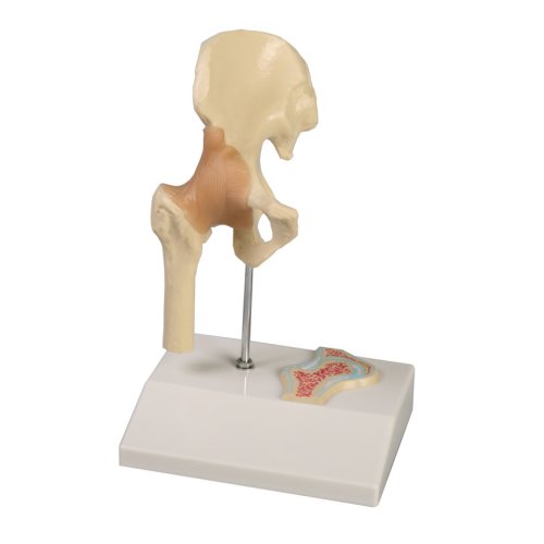 Miniature hip joint model with cross section