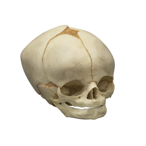 Fetal skull 40 &frac12; weeks