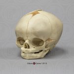 Fetal skull 40 ½ weeks