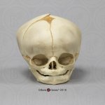 Fetal skull 40 ½ weeks