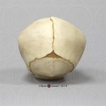 Fetal skull 40 ½ weeks