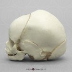 Fetal skull 31 weeks