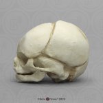 Fetal skull 21 ½ weeks