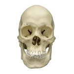 Scaphocephalic skull model