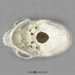 Skaphozephaler Schädel-Modell