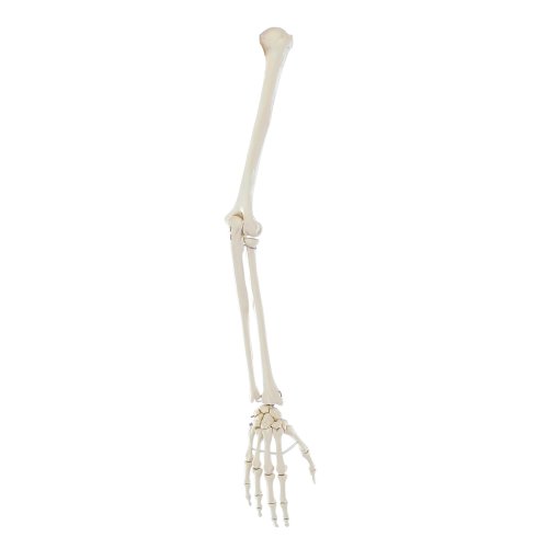 Arm skeleton model