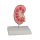 Kidney stone model - EZ Augmented Anatomy